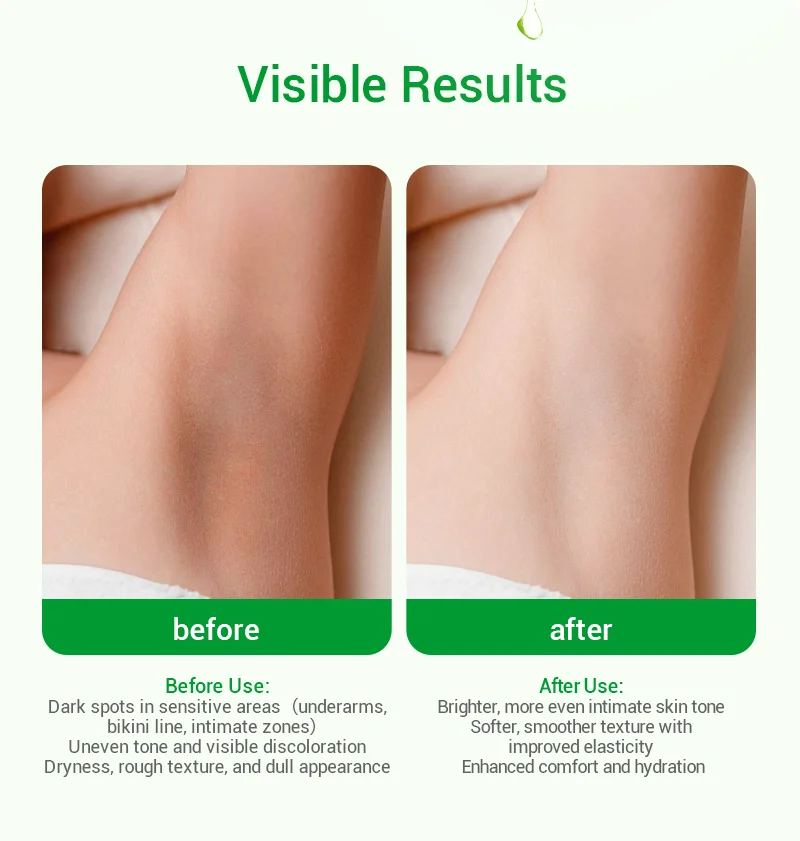 Comparison of armpit skin before and after using a treatment, showing noticeable improvement in tone and texture.